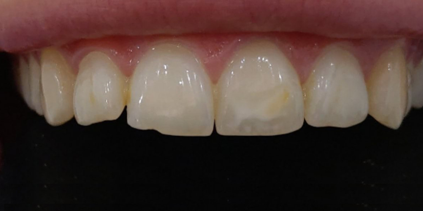Before image